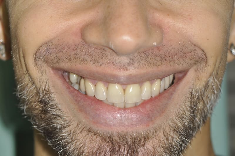studio dentistico Milano faccette dentali