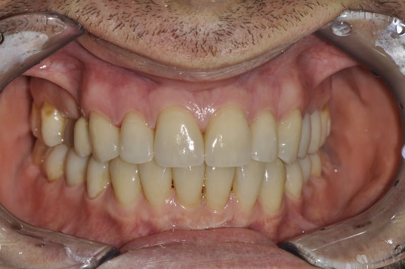 studio dentistico Milano faccette dentali