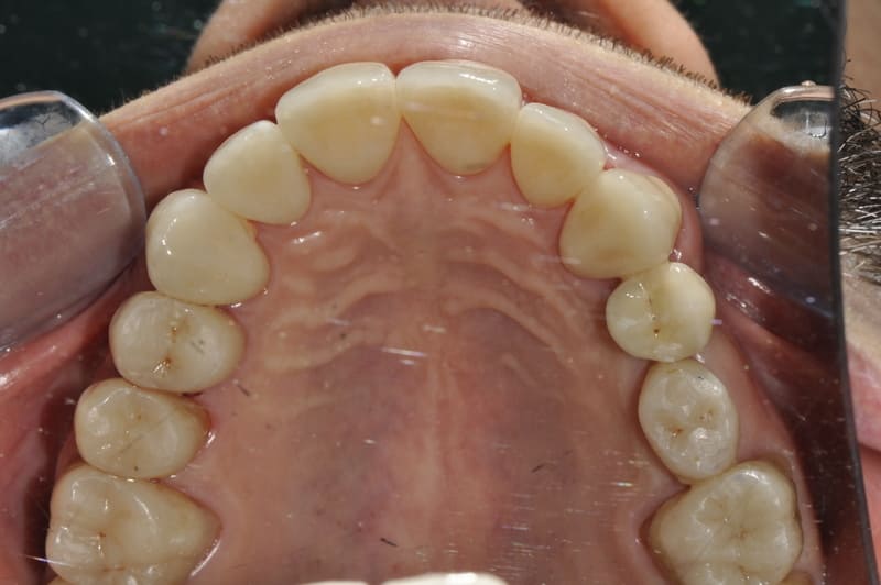 studio dentistico Milano faccette dentali