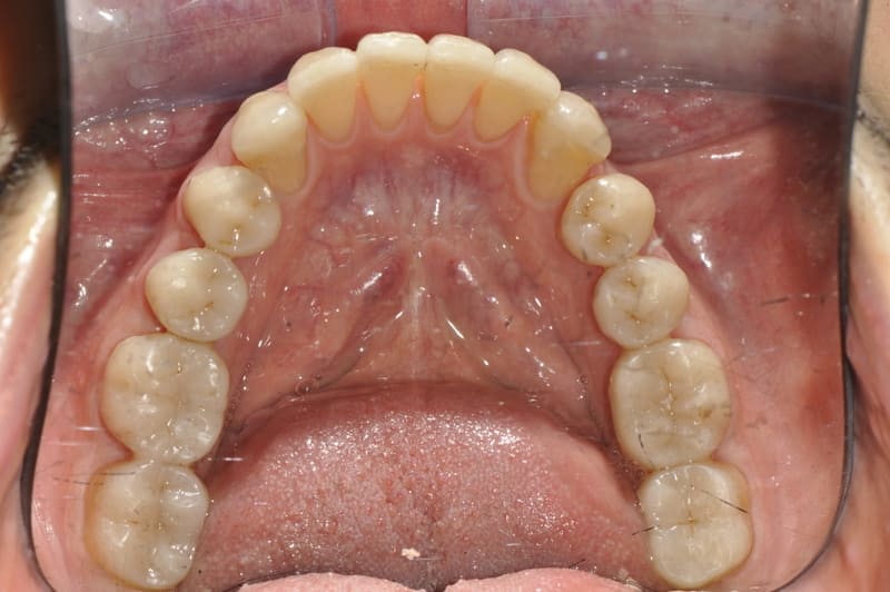 studio dentistico Milano faccette dentali