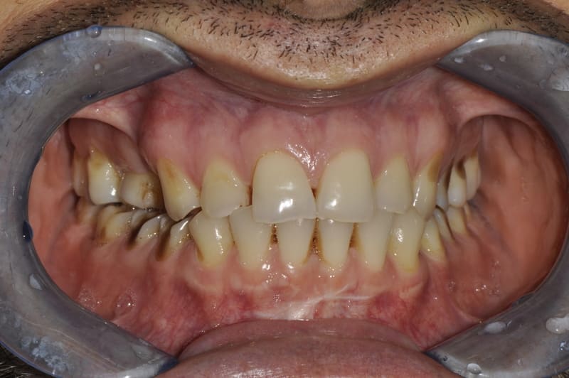 studio dentistico Milano faccette dentali