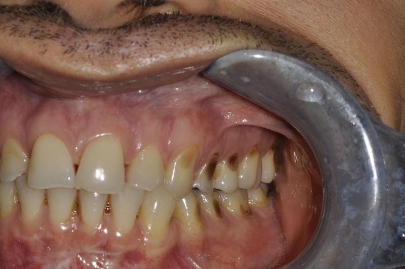studio dentistico Milano faccette dentali