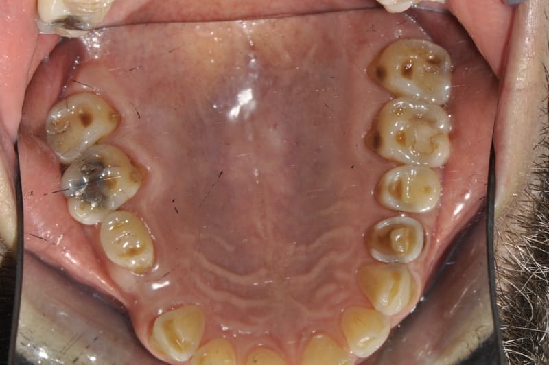studio dentistico Milano faccette dentali