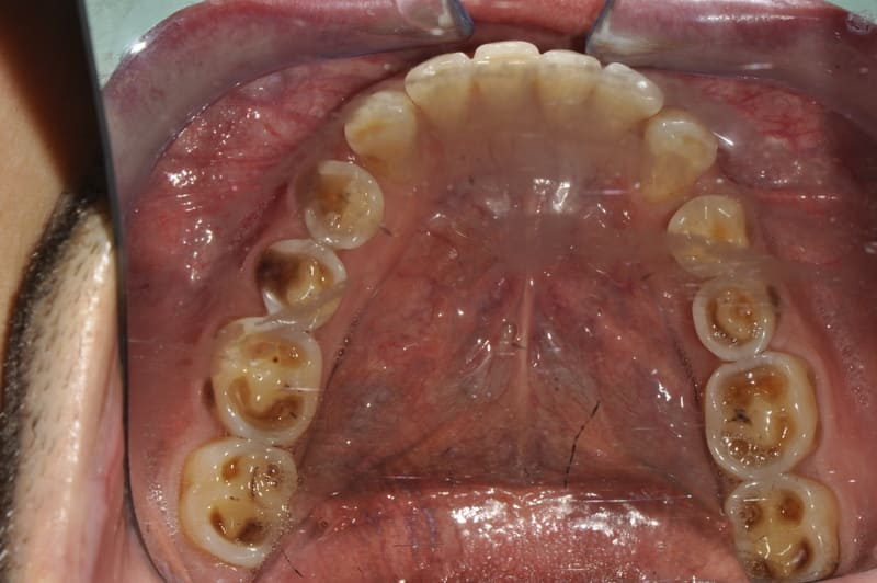 studio dentistico Milano faccette dentali